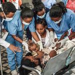 A woman receives treatment.