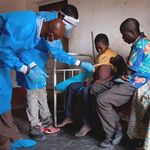 Monkeypox